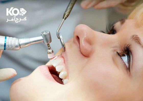 جرم گیری دندان در کلینیک دندان پزشکی ابن سینا