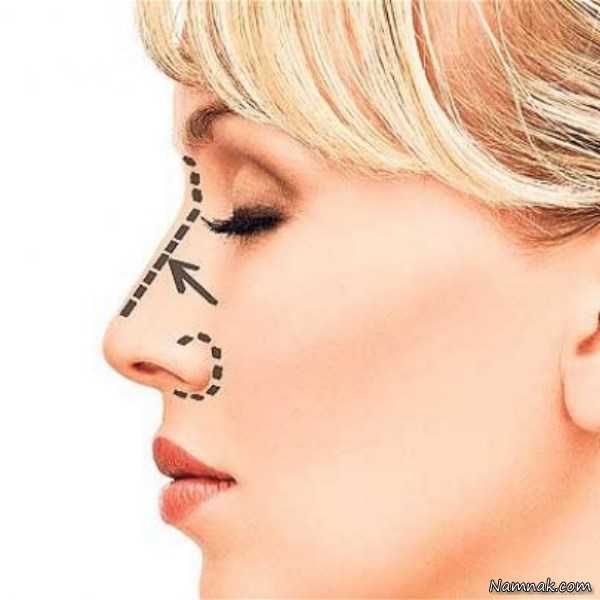 جراحی زیبایی