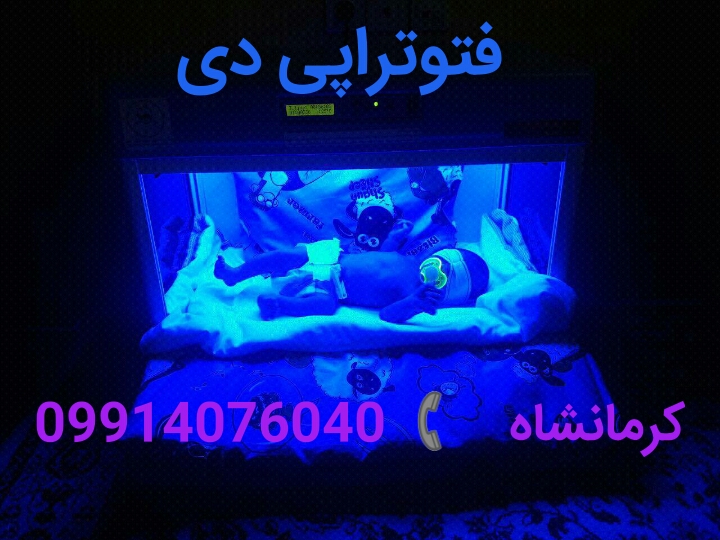 اجاره دستگاه زردی نوزادان کرمانشاه
