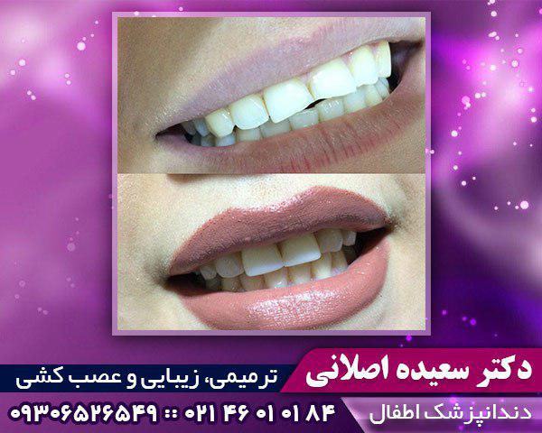 دندانپزشکی در غرب تهران