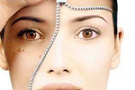 سفیداب پنبه روی حلما