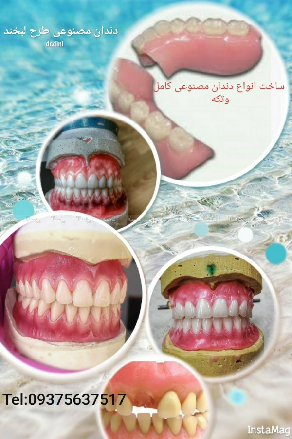 دندان مصنوعی
