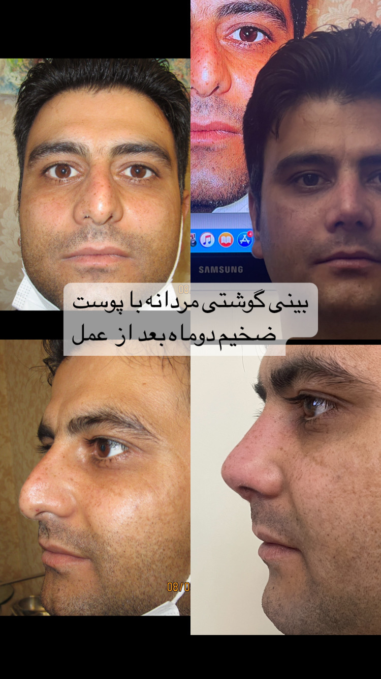 انجام عمل های زیبایی توسط دکتر خاص احمدی