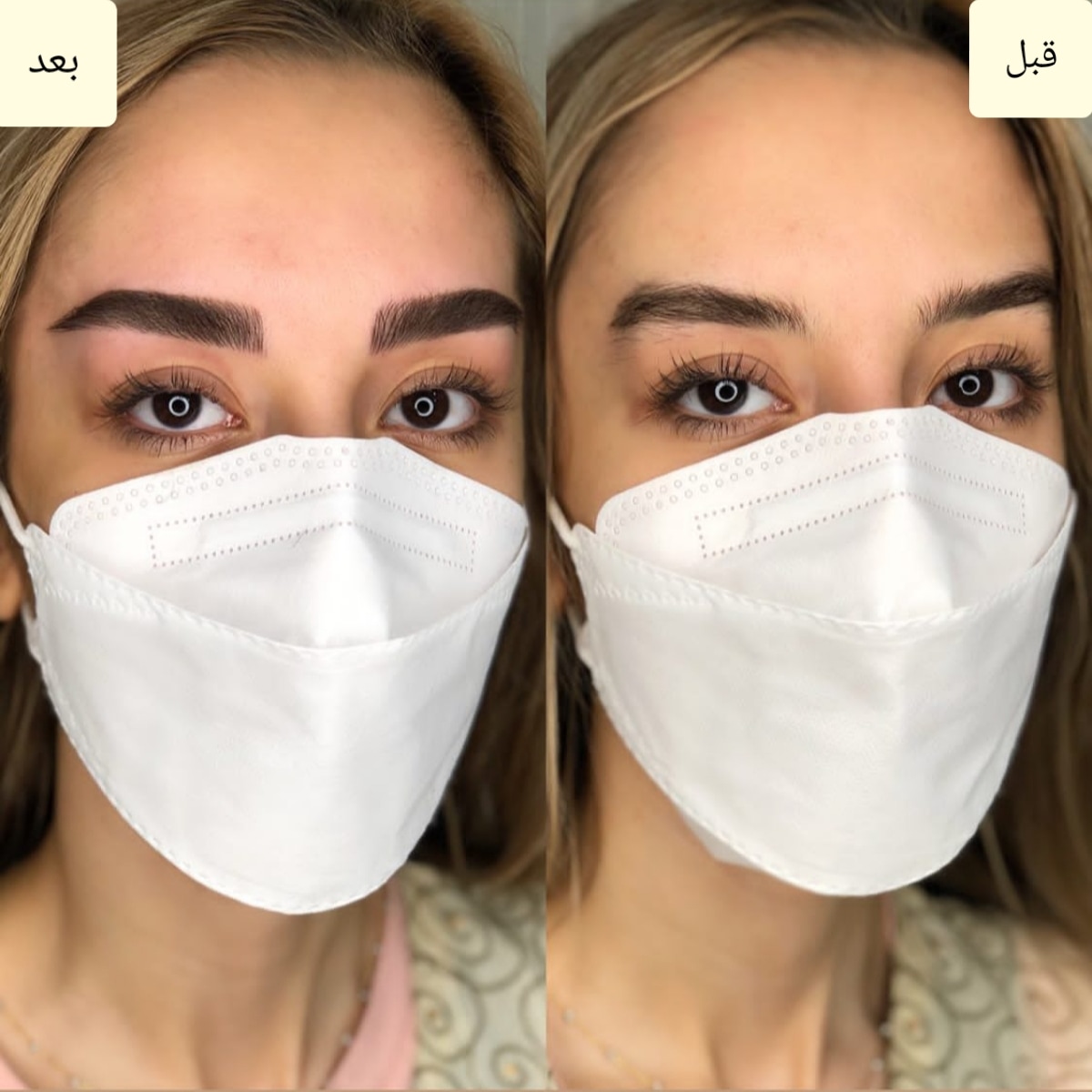بهترین فیبروزکار مشهد