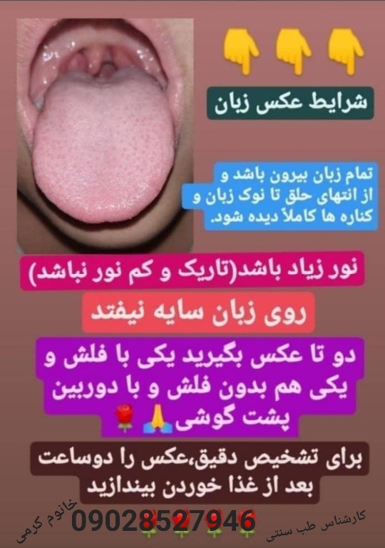 آیا از تب سنتی آگاهی دارید