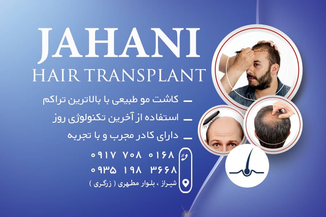 کلینیک کاشت مو و ابرو جهانی