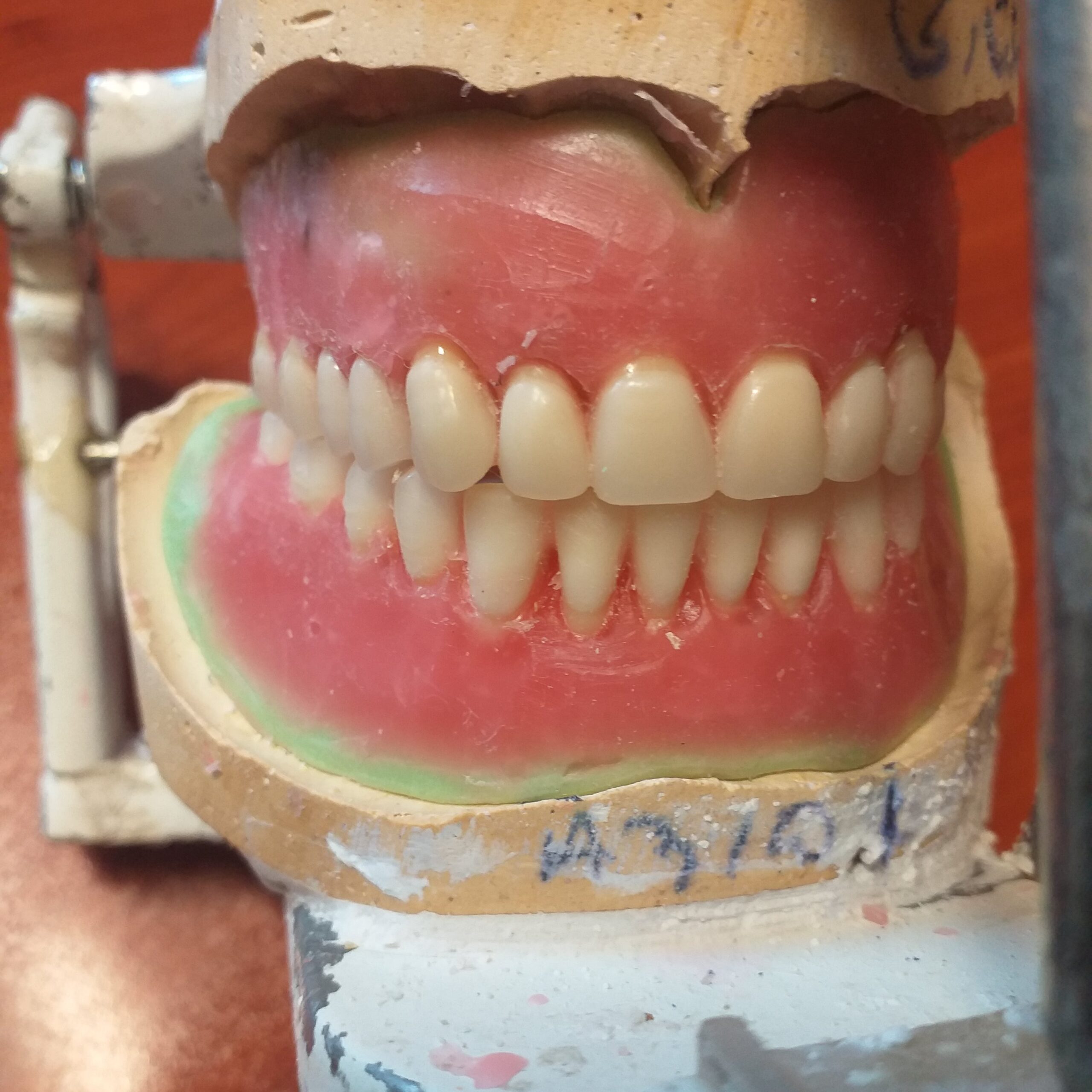 لابراتوار دندانسازی دندان مصنوعی