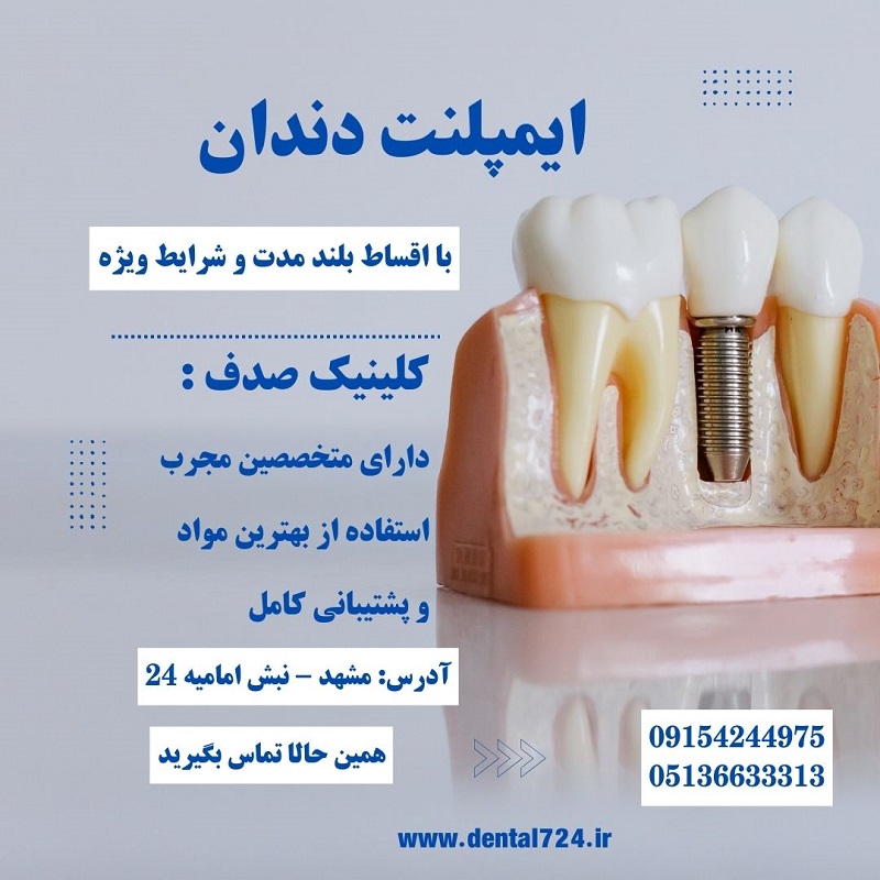 درمان ایمپلنت بدون فشار مالی با اقساط بلند مدت