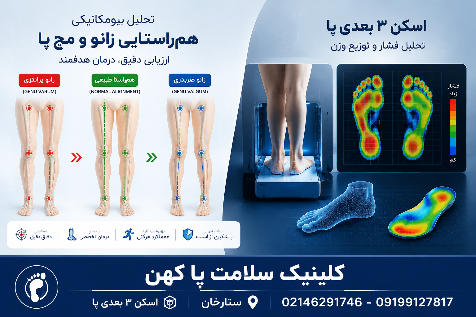 ارزیابی بیومکانیک انحرافات زانو و مچ پا (پرانتزی و ضربدری)